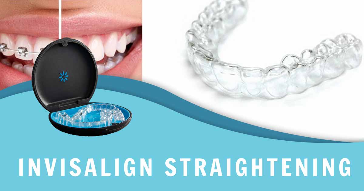 Invisalign Treatment | Invisalign Aligners by Smiles of Lindenhurst