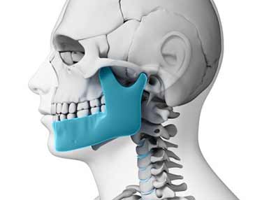 general-dentistry-fractured-jaw