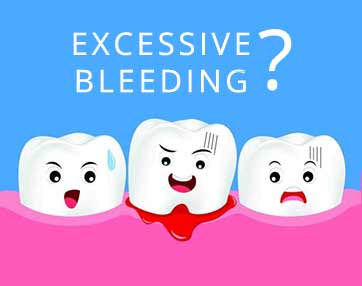 general-dentistry-excessive-bleeding